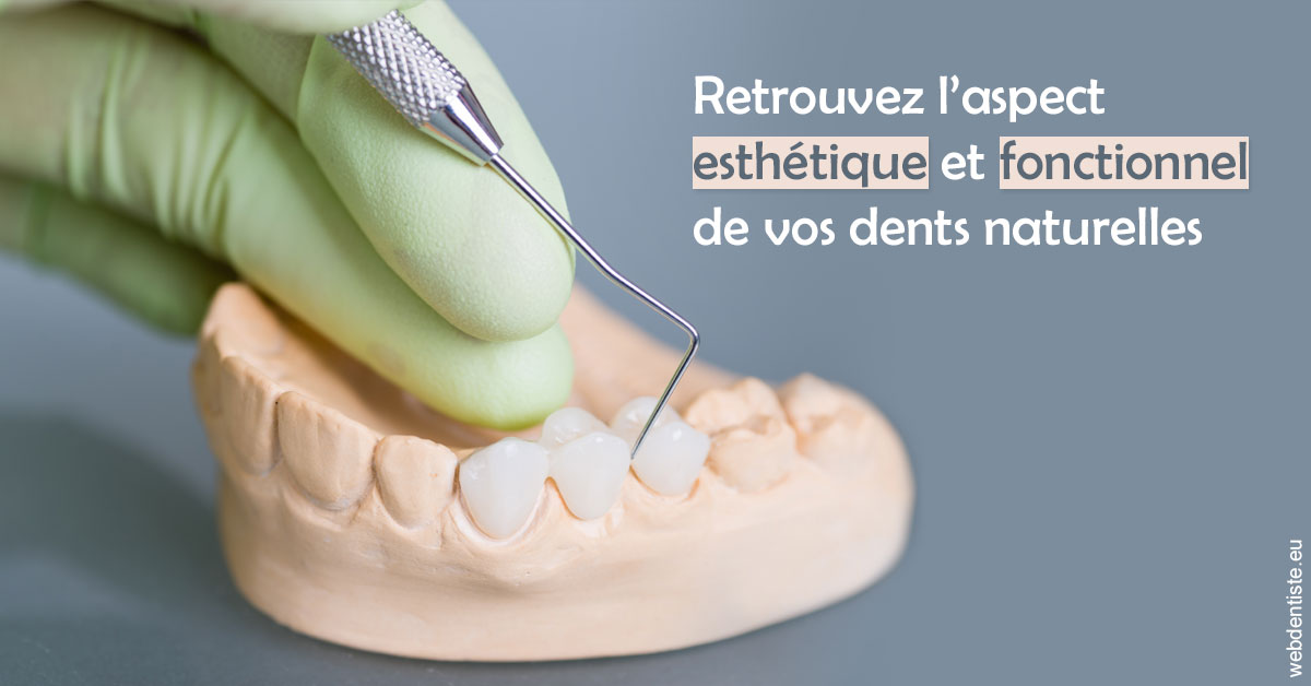 https://dr-jacques-schouver.chirurgiens-dentistes.fr/Restaurations dentaires 1