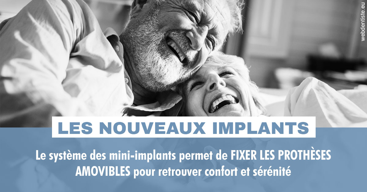 https://dr-jacques-schouver.chirurgiens-dentistes.fr/Les nouveaux implants 2