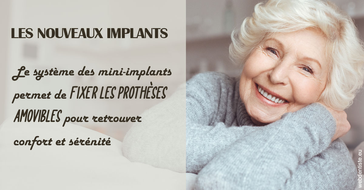https://dr-jacques-schouver.chirurgiens-dentistes.fr/Les nouveaux implants 1