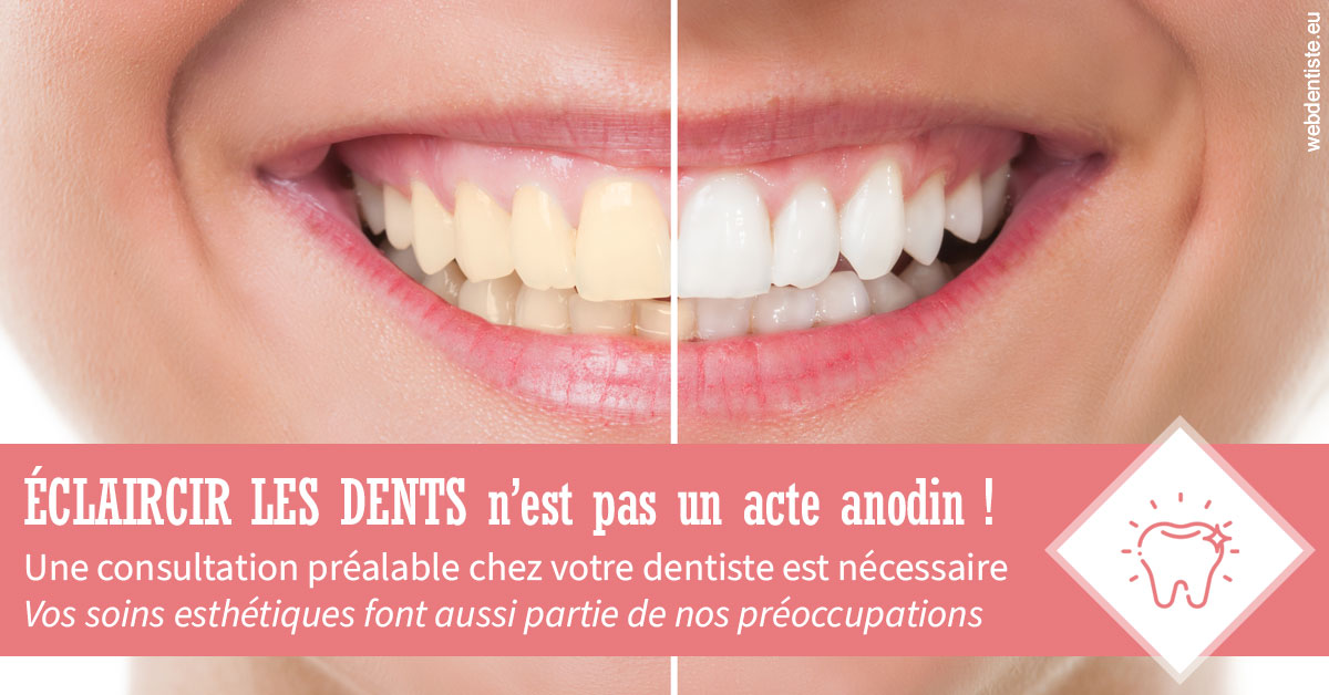https://dr-jacques-schouver.chirurgiens-dentistes.fr/Eclaircir les dents 1