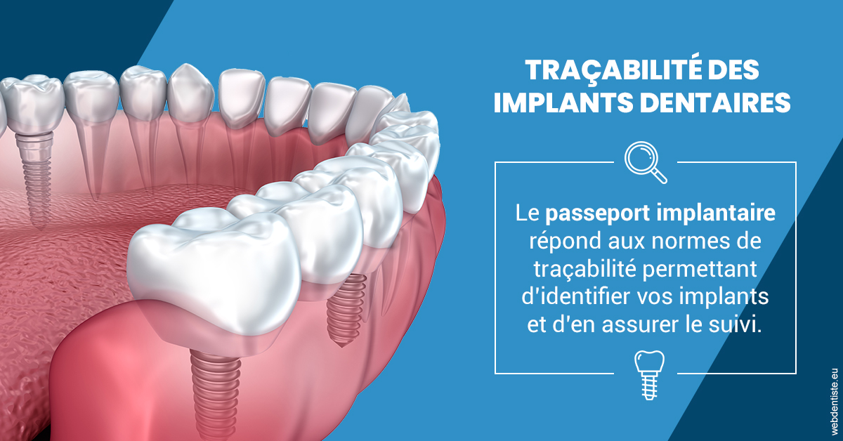 https://dr-jacques-schouver.chirurgiens-dentistes.fr/T2 2023 - Traçabilité des implants 1