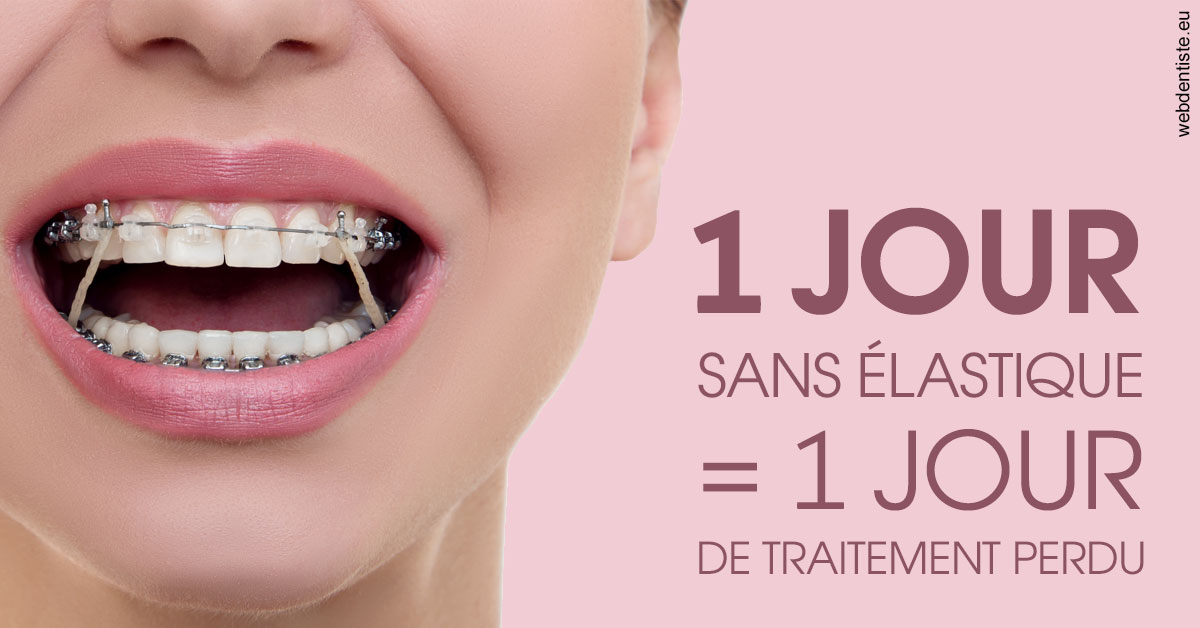 https://dr-jacques-schouver.chirurgiens-dentistes.fr/Elastiques 2
