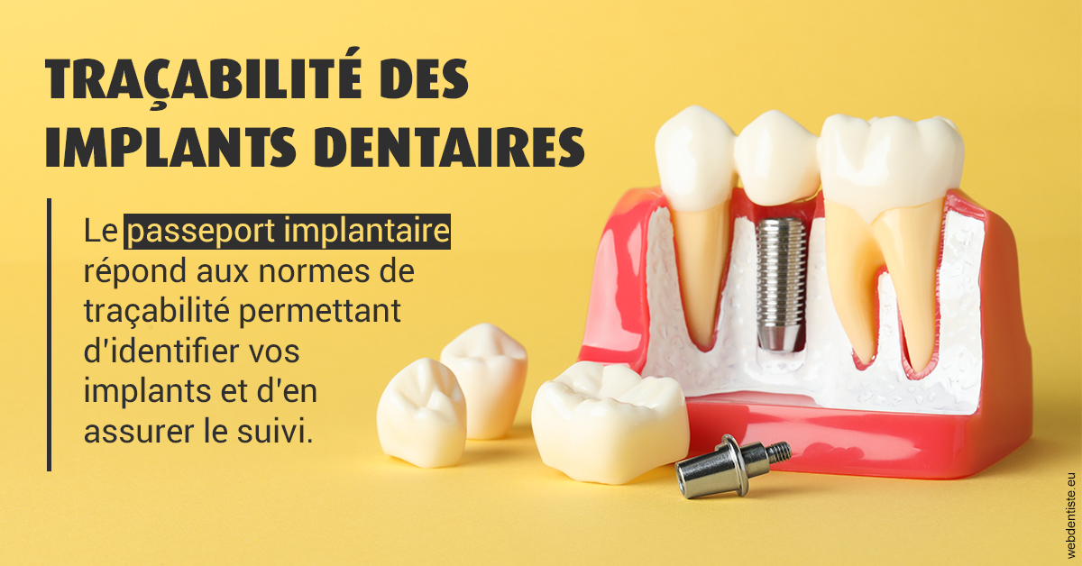 https://dr-jacques-schouver.chirurgiens-dentistes.fr/T2 2023 - Traçabilité des implants 2