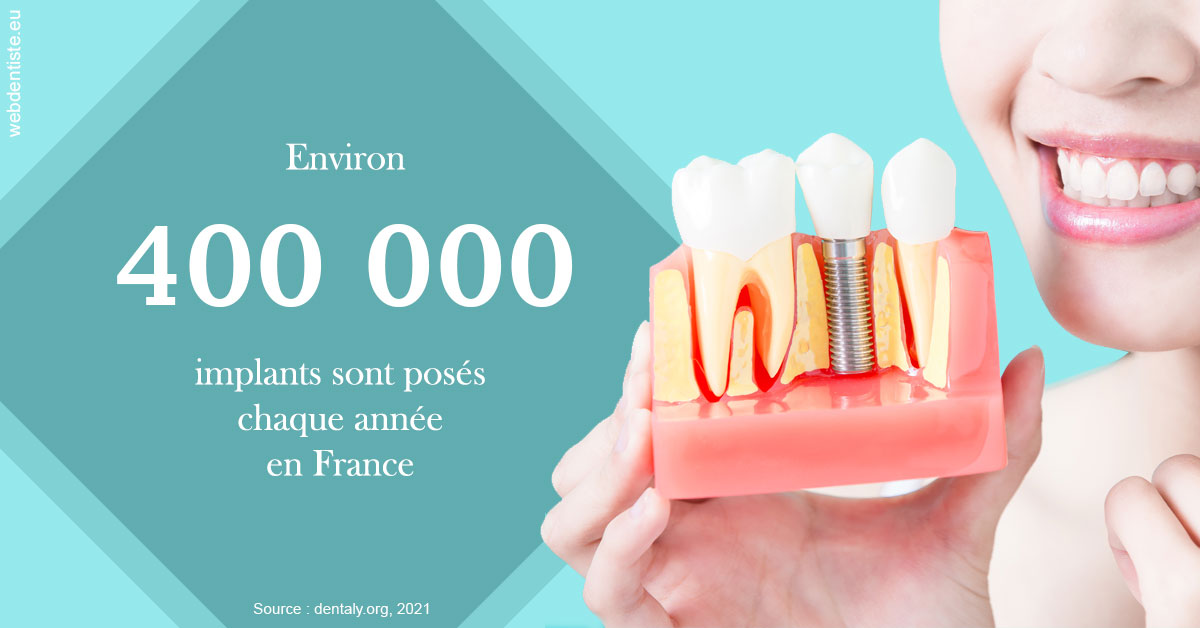 https://dr-jacques-schouver.chirurgiens-dentistes.fr/Pose d'implants en France 2